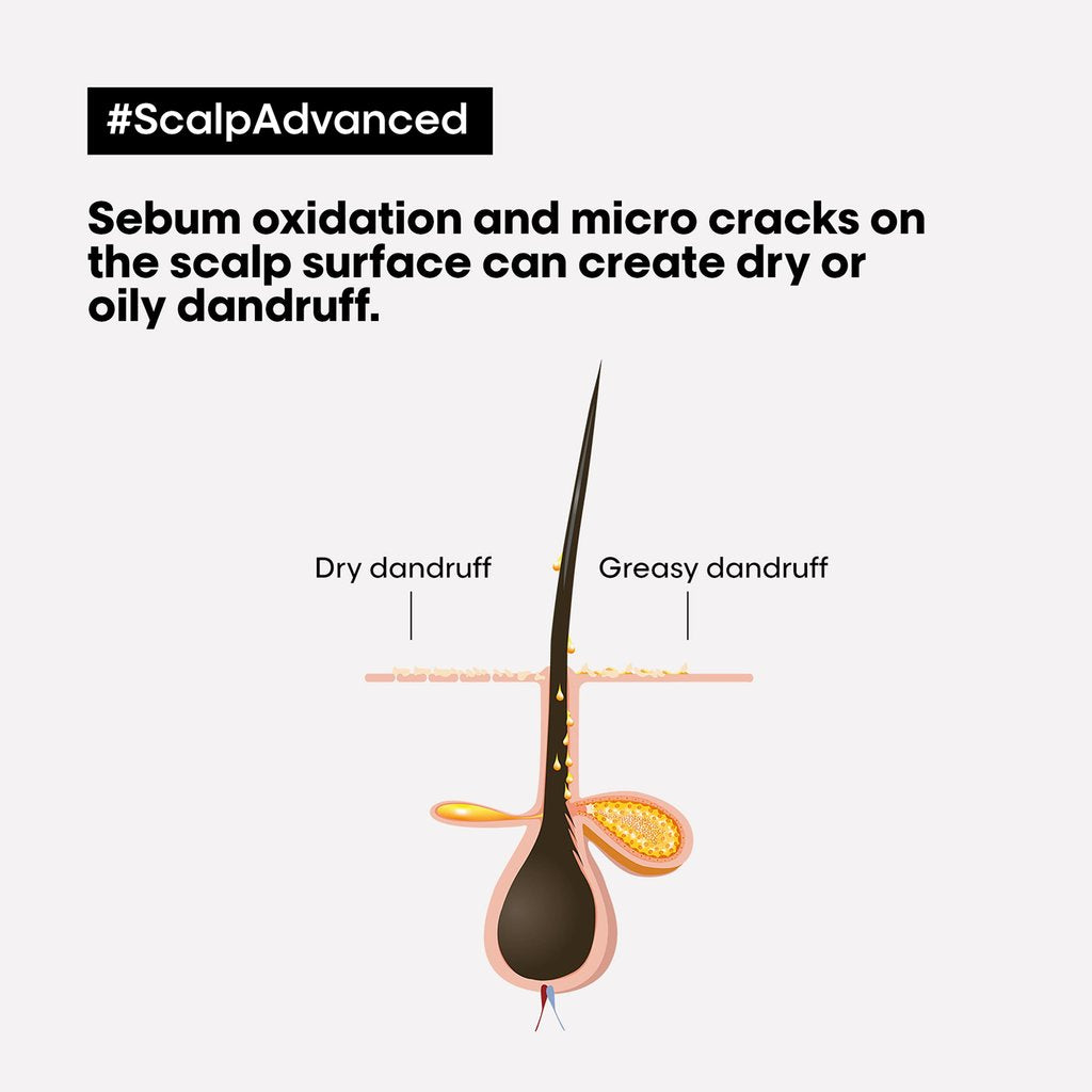 Loreal Professionnel Scalp Advances Anti-Dandruff Shampoo 300ml