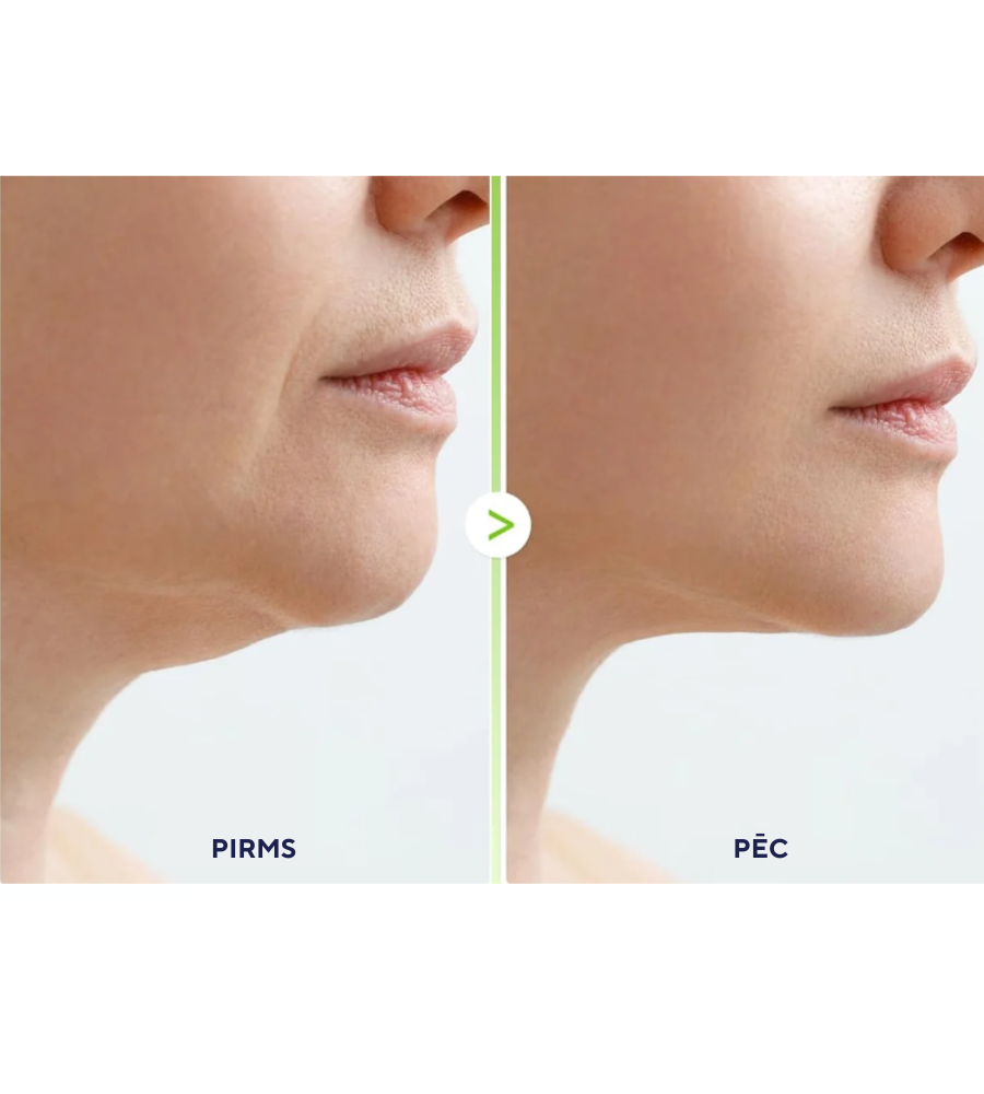 Dr. Melaxin Cactox Cooling V-Up Mask 4 pcs