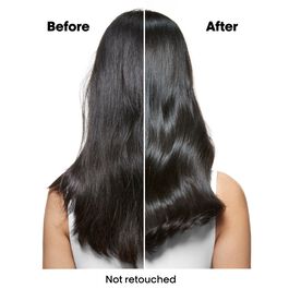 Loreal Professionnel Scalp Advances Anti-Dandruff Shampoo 300ml