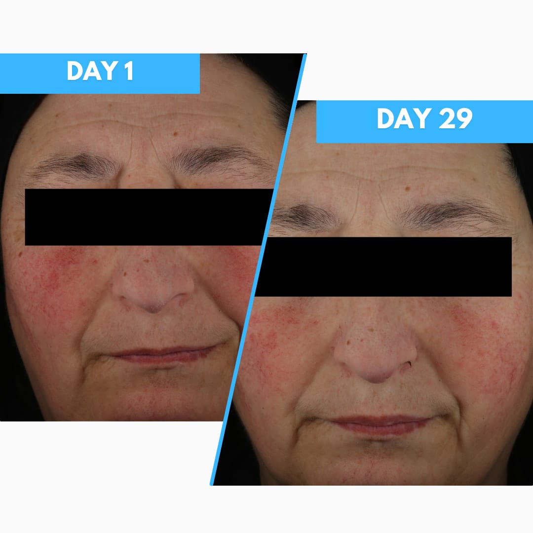 Synergy Therm Anti-Redness Cream - Rosa Control 50 ml