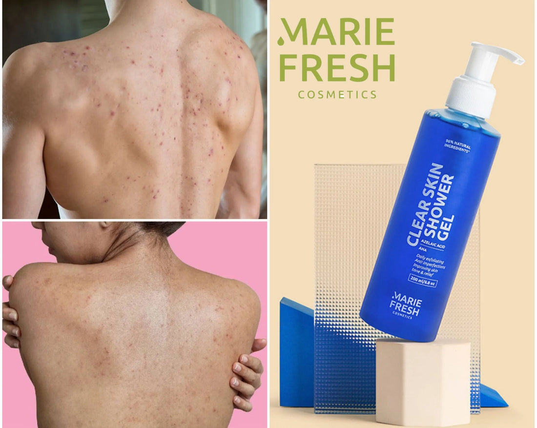 Marie Fresh Clear Skin Shower Gel 200ml