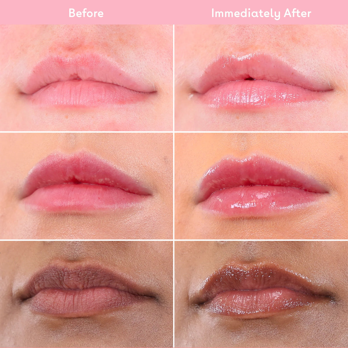 Q+A Collagen Anti-Age Lip Balm 10ml