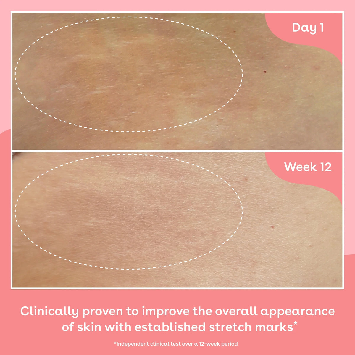 Q+A Collagen Body Oil 150ml