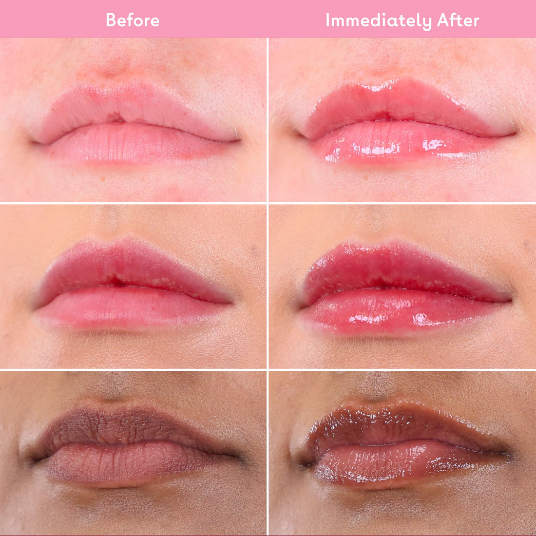 Q+A Hyaluronic Acid Hydrating Lip Balm 10ml