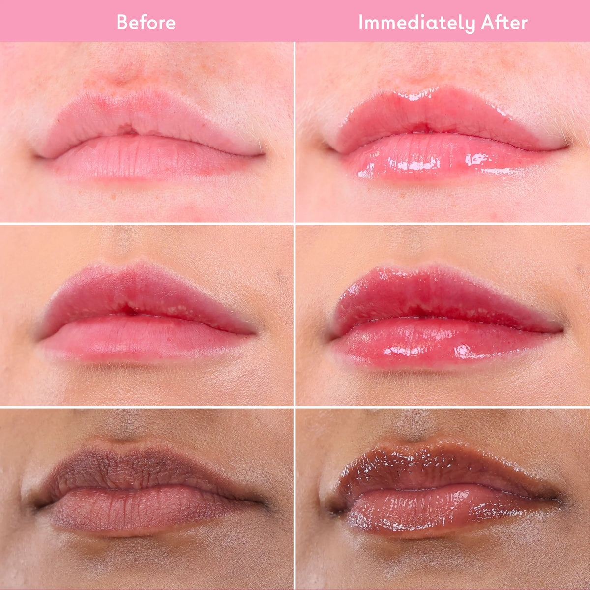 Q+A Hyaluronic Acid Hydrating Lip Balm 10ml