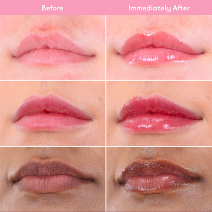 Q+A Hyaluronic Acid Hydrating Lip Balm 10ml