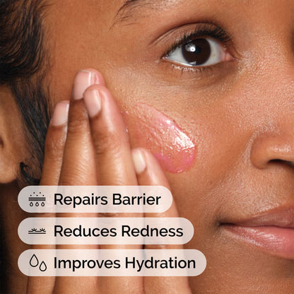 The Ordinary Soothing and Barrier Support Serum 15ml