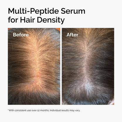 The Ordinary Multi-Peptide Serum for Hair Density 60ml